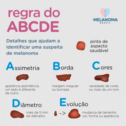 Voc Conhece A Regra Do Abcde Instituto Melanoma Brasil