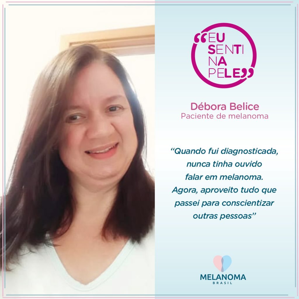A confeiteira Débora Belice, nunca tinha ouvido falar em melanoma, até que em 2018 sentiu a doença na pele.