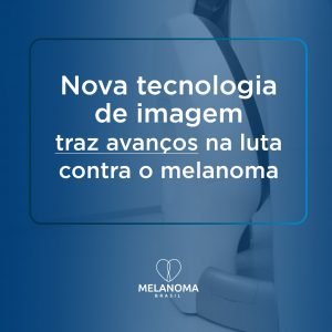 Métodos inovadores de diagnóstico do melanoma trazem avanço na luta contra a doença