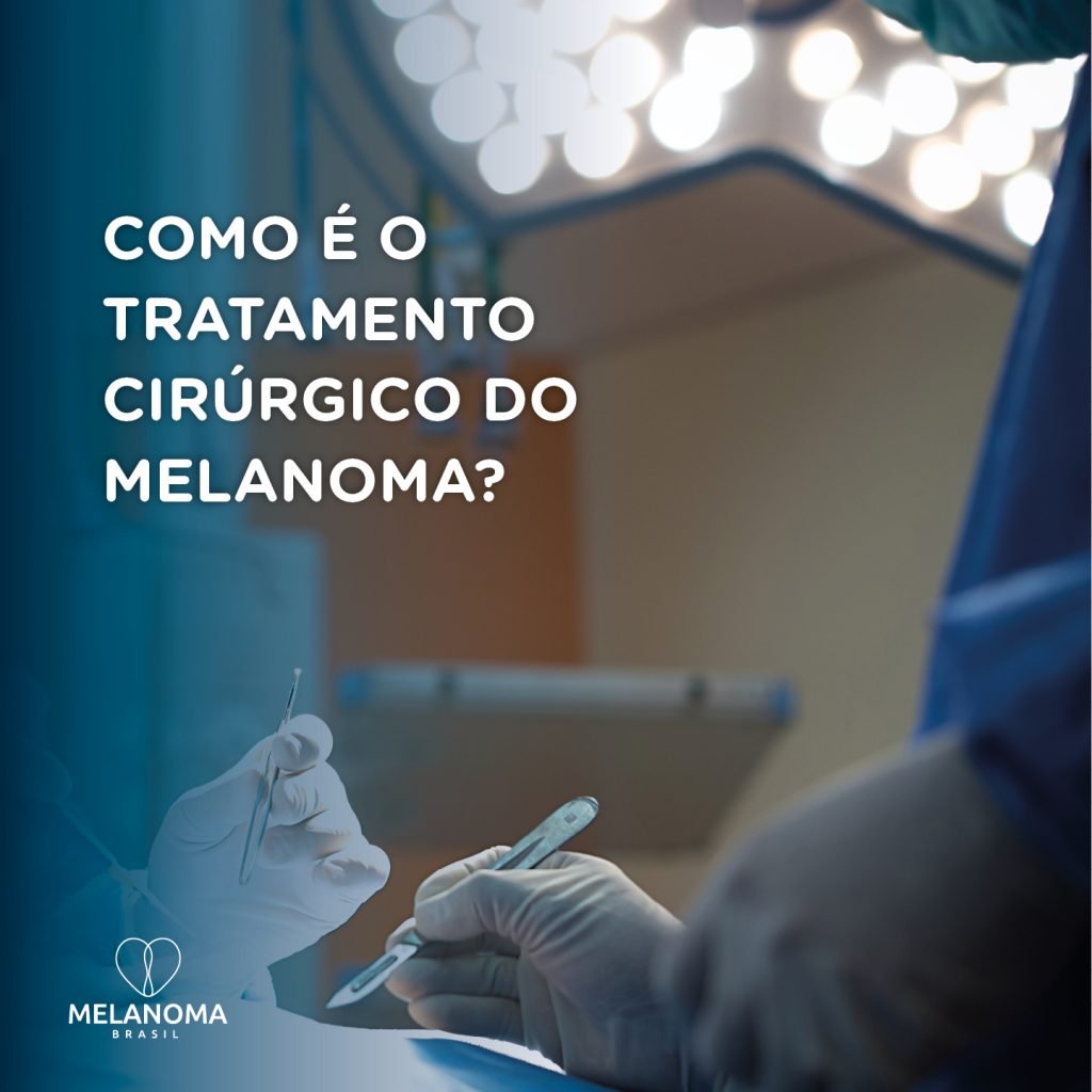 O tratamento cirúrgico pode ser realizado em todos os tipos de melanoma.